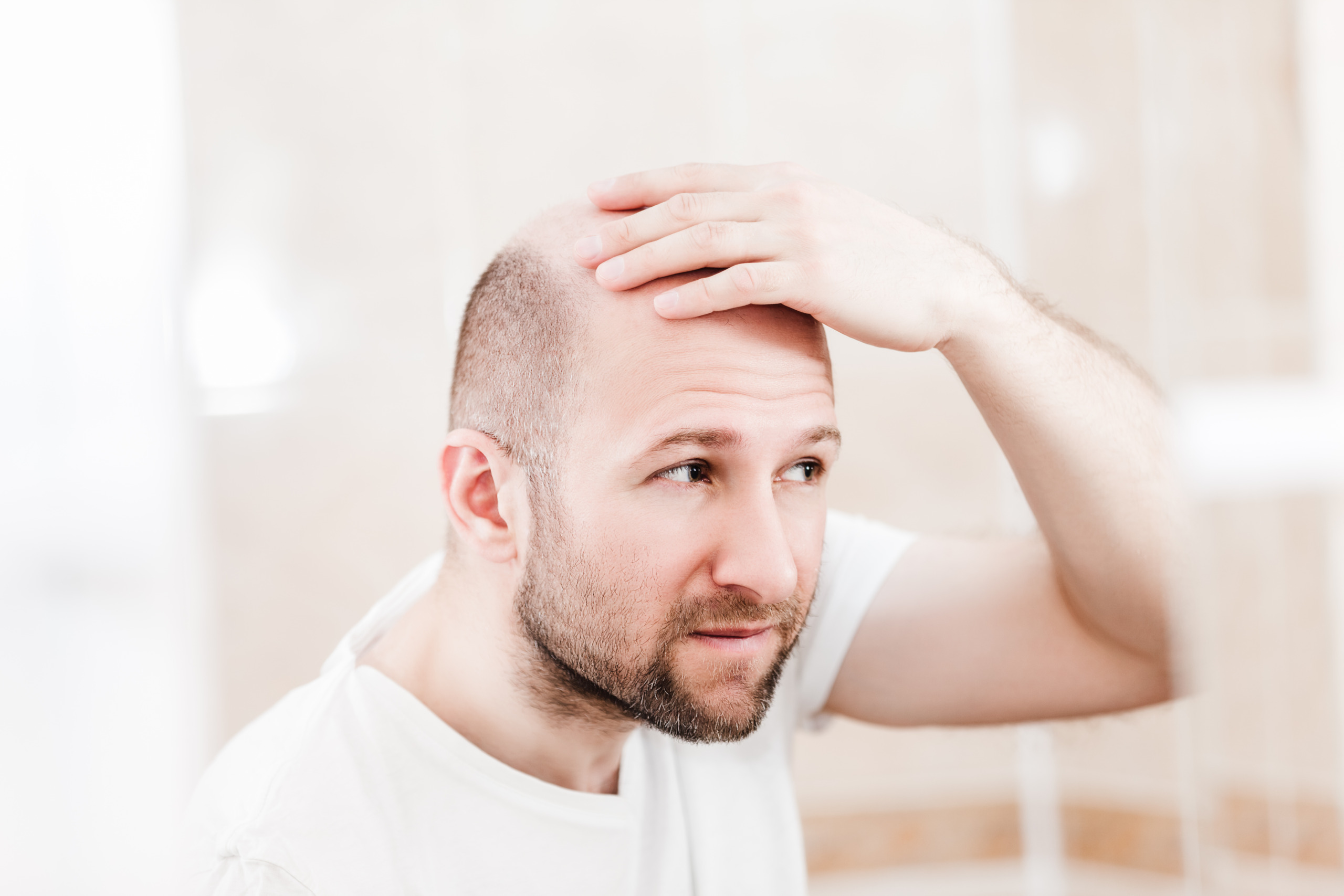 best hair transplant in islamabad