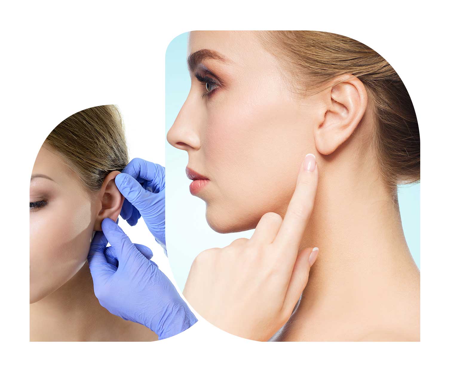 Otoplasty in Islamabad
