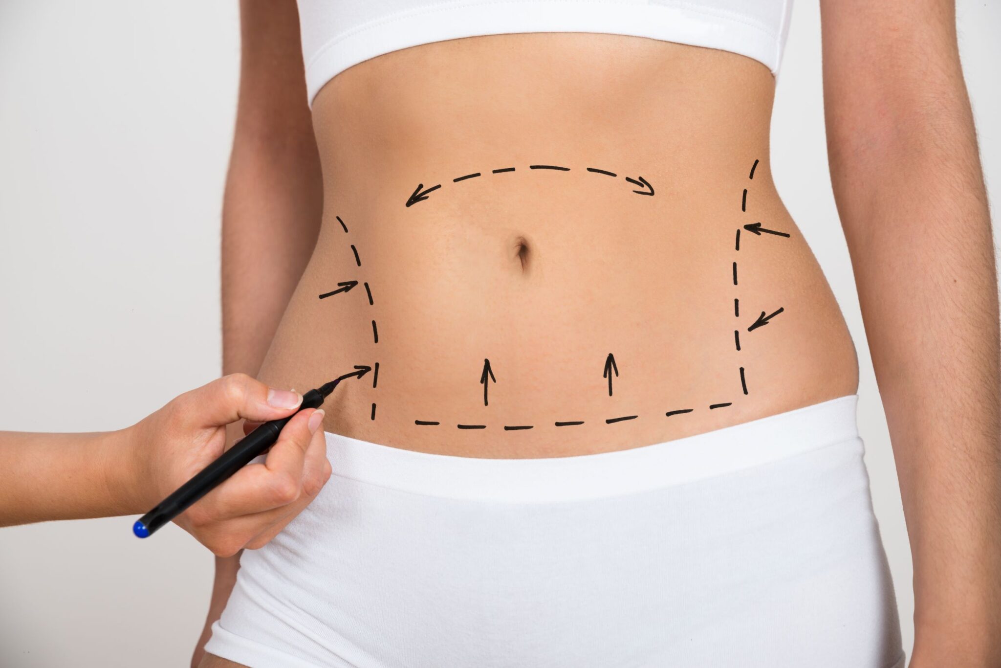 Liposuction in Islamabad