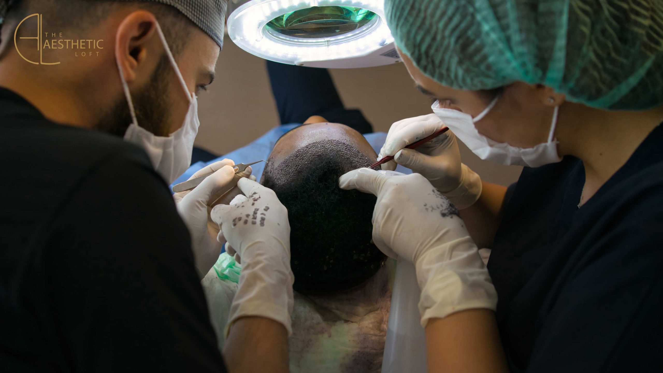 How Many Hair Transplants Can You Get