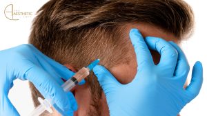 Is PRP Necessary After Hair Transplant