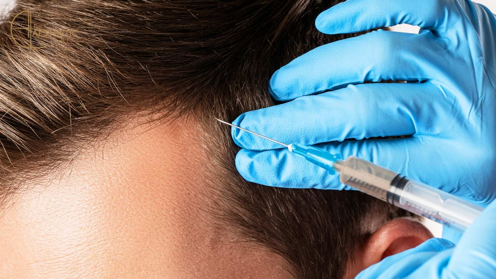 Comprehensive Guide to Hair PRP (Platelet-Rich Plasma) Therapy
