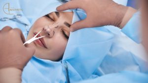 Comprehensive Guide to Rhinoplasty
