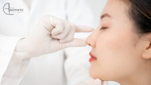 Rhinoplasty in Islamabad