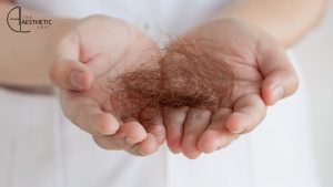 Early Signs of Hair Loss