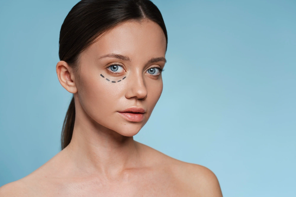 undereye dark circle treatment in islamabad