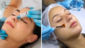 Hydrafacial vs Chemical Peels